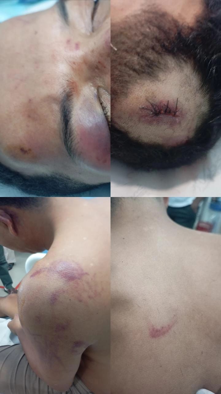 Unit Reskrim Polsek Sagulung Ungkap Kasus Dugaan Pengeroyokan Di Kawasan Cafe Winner